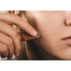 Ahava Les Pépites Beauté Patchs Stop Boutons