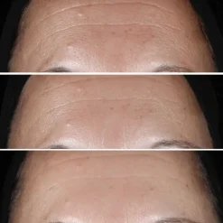 CLINIQUE Smart Clinical Repair                Sérum Correcteur Anti-Rides