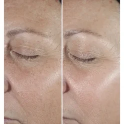 CLINIQUE Smart Clinical Repair                Sérum Correcteur Anti-Rides