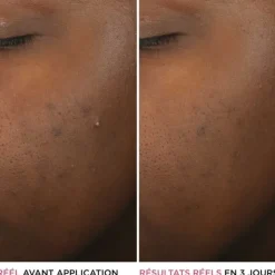 It Cosmetics Bye Bye Breakout                Sérum anti-acné à l'acide salicylique