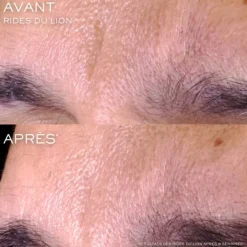 LANCÔME Rénergie C.R.x. Triple Sérum Rétinol                Sérum Visage