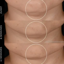 LANCÔME Rénergie H.P.N. 300-Peptide                Crème Anti-Âge Haute-Performance